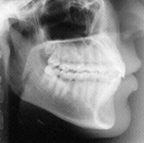 Radiologia Odontológica no Centro de Recife